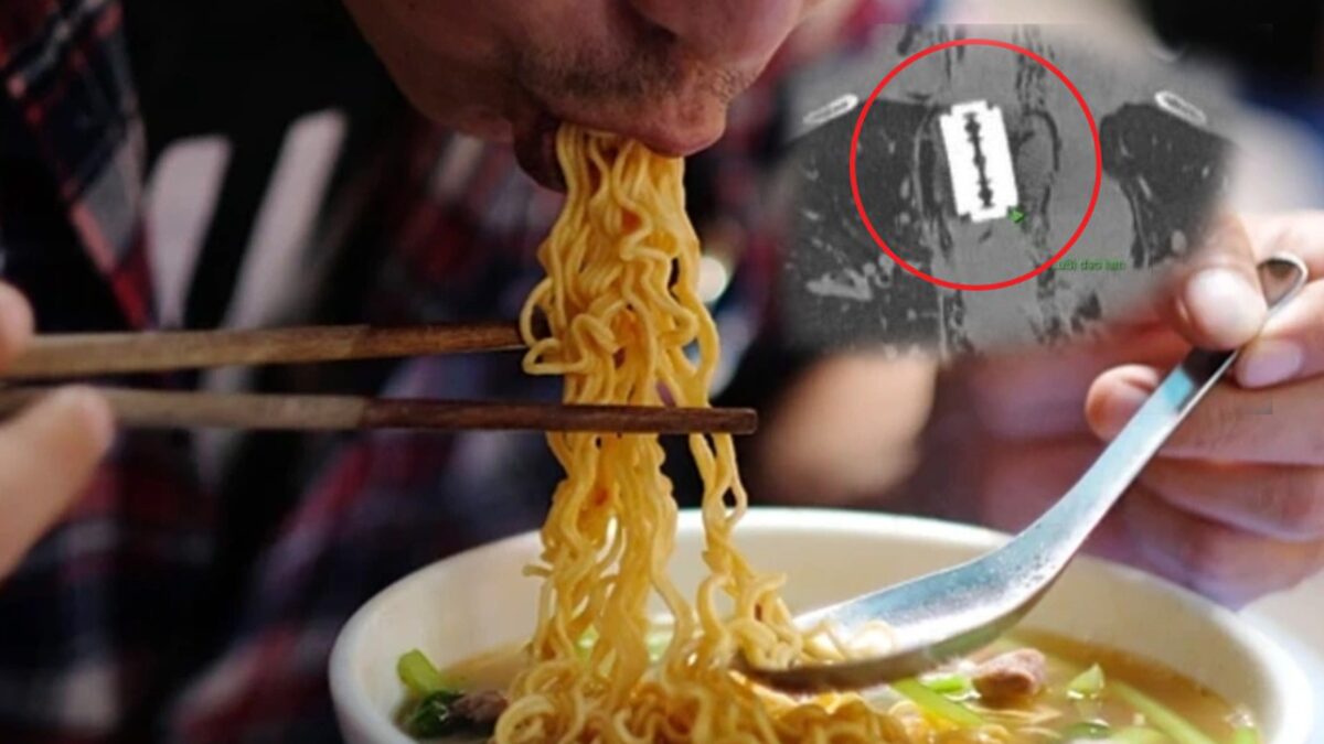 Người đàn ông 45 tuổi nuốt phải lưỡi dao lam khi vừa ăn mì tôm vừa xem điện thoại