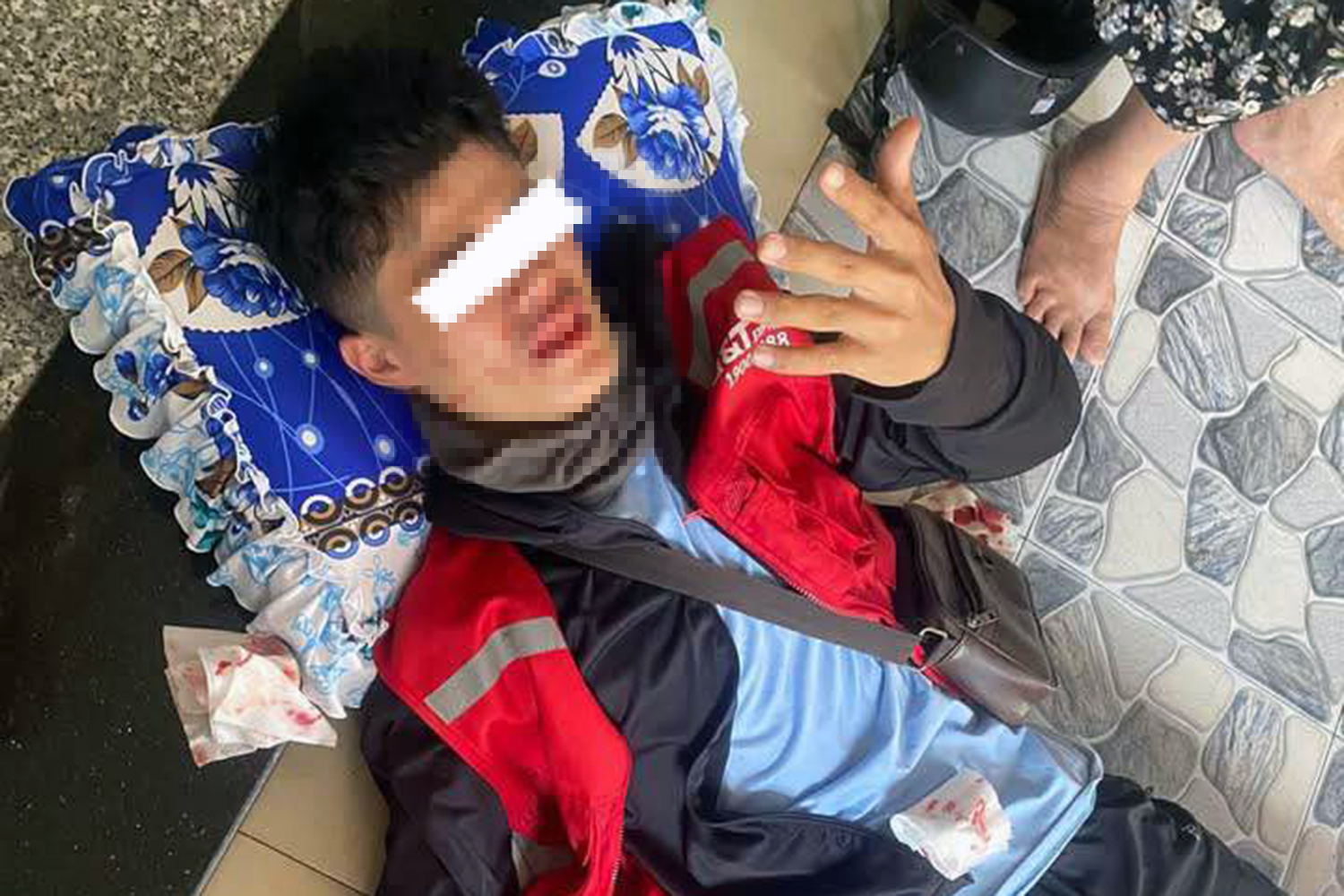 男送货员在送货时被追赶打伤鼻子，额头肿胀